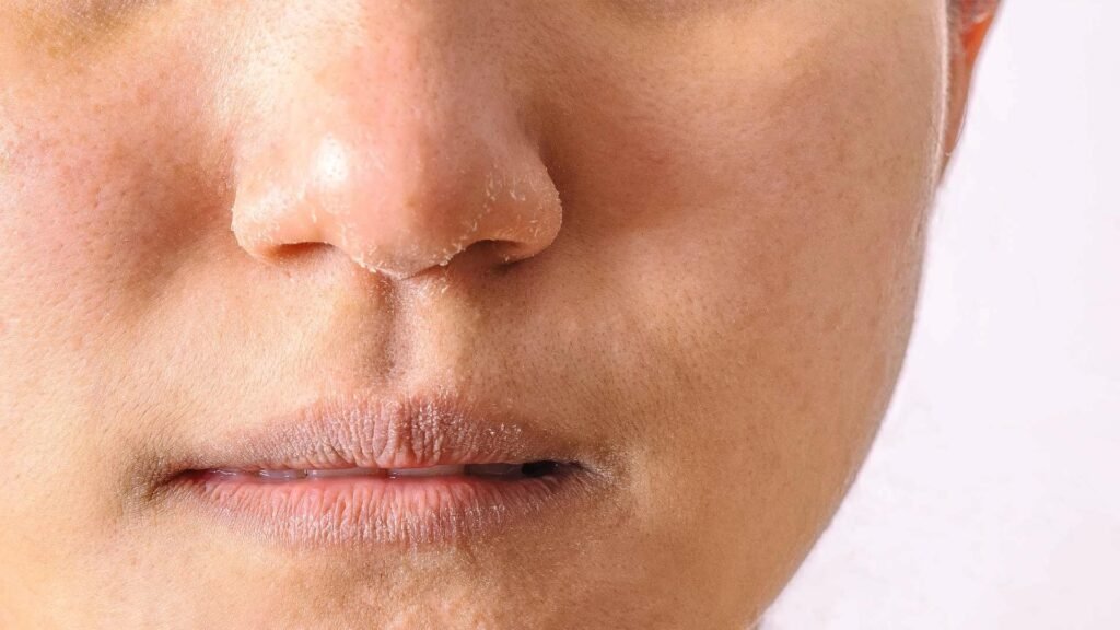 Cerave Psoriasis cleanser -Dry and winter season