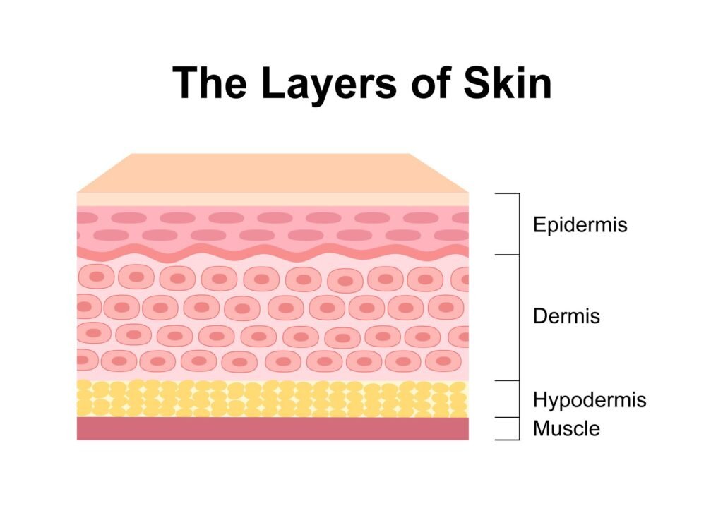 Psoriasis disrupts the lipid barrier, increasing water loss and scaling.